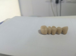 Most porcelanowy Most porcelanowy