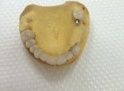 Most porcelanowy Most porcelanowy