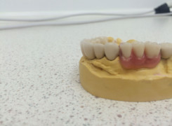 Most z uzupełnieniem ruchomym Most z uzupełnieniem ruchomym