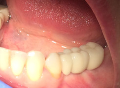 Efekt końcowy Efekt końcowy