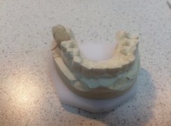 Most pełnoceramiczny Most pełnoceramiczny