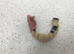 Most z uzupełnieniem bocznym przygotowany do założenia na teleskopy Most z uzupełnieniem bocznym przygotowany do założenia na teleskopy