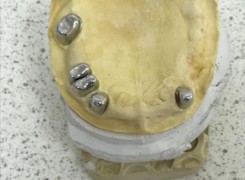 Teleskopy na modelu Teleskopy na modelu