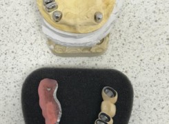 Widoczne teleskopy oraz most z elementem uzupełnienia bocznego Widoczne teleskopy oraz most z elementem uzupełnienia bocznego