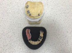 Widoczne teleskopy oraz most z elementem uzupełnienia bocznego Widoczne teleskopy oraz most z elementem uzupełnienia bocznego