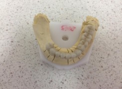 Most porcelanowy dolny Most porcelanowy dolny