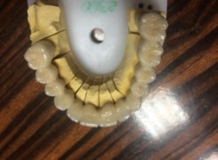 Most porcelanowy górny Most porcelanowy górny