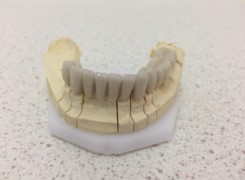 Most porcelanowy dolny Most porcelanowy dolny