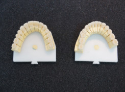 28 cyrkonowych koron – etap przygotowań na modelach technicznych 28 cyrkonowych koron – etap przygotowań na modelach technicznych