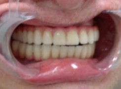 Wizyta kontrolna po 1 miesiącu użytkowania pracy przez Pana Ryszarda Wizyta kontrolna po 1 miesiącu użytkowania pracy przez Pana Ryszarda